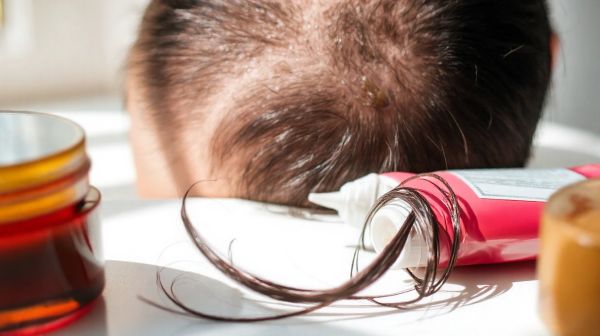 Top 10 des meilleurs produits pour un scrub cuir chevelu efficace